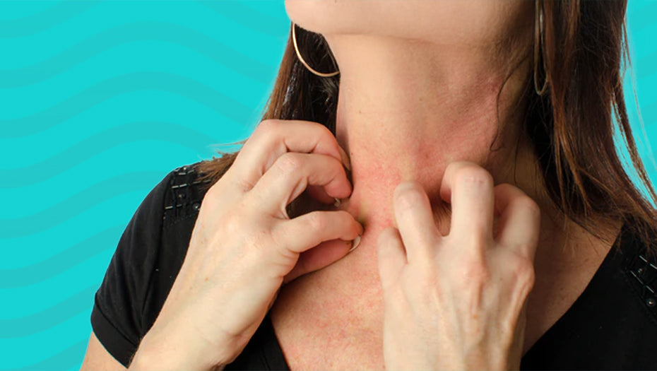 Chlorine Rash Prevention for Swimmers with Sensitive Skin