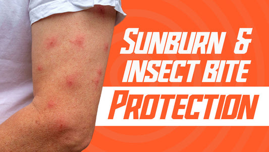 How to Protect Your Skin from Both Sunburn and Insect Bites on a Hike