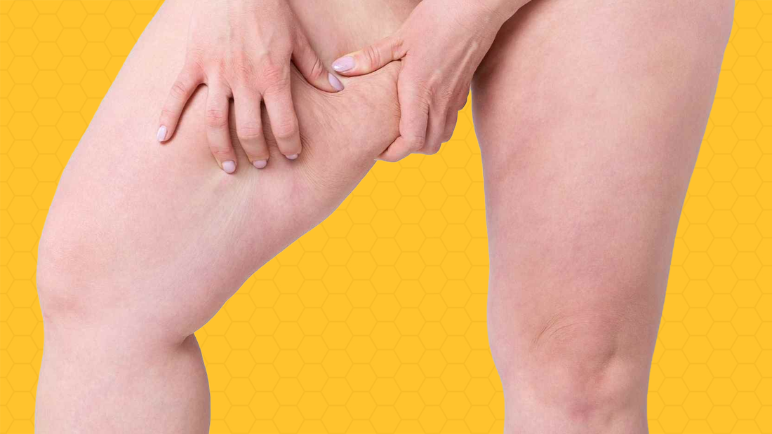 Chafing in Summer vs. Winter: How to Adjust Your Skincare Routine