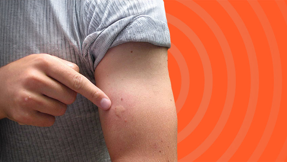 How to Avoid Insect Bites While Trekking: Insect Repellent Sunscreen Tips