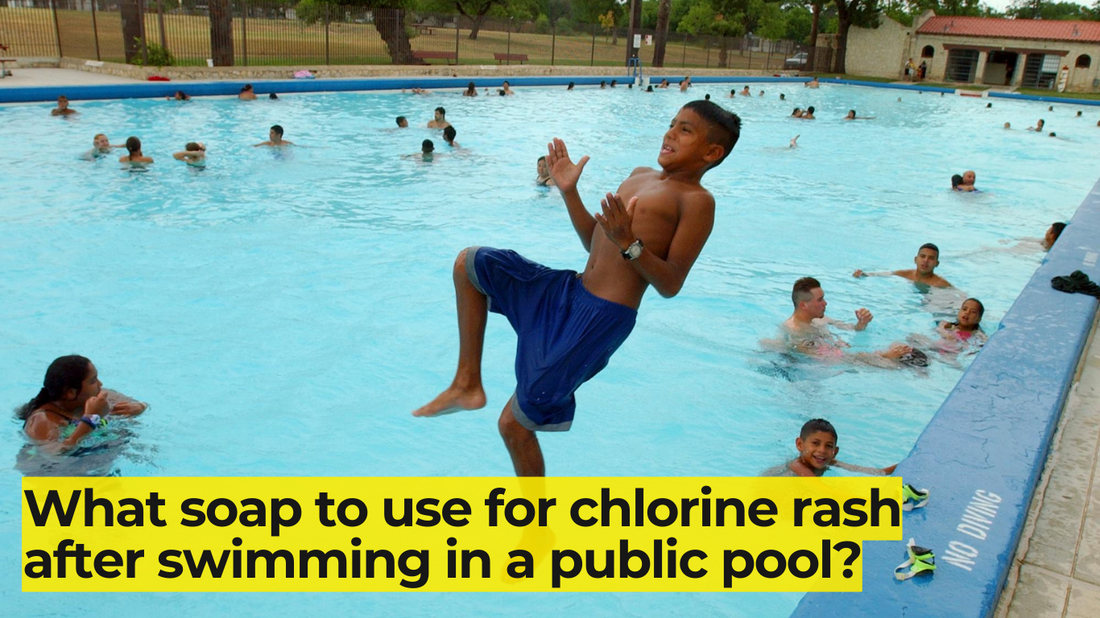 What soap to use for chlorine rash after swimming in a public pool?