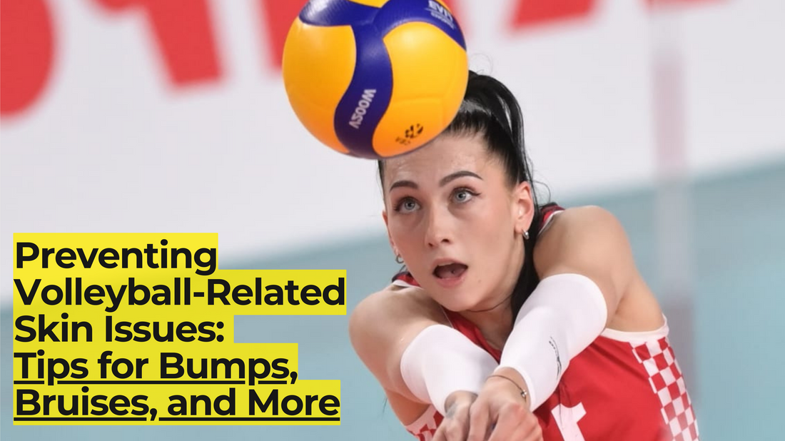 Preventing Volleyball-Related Skin Issues: Tips for Bumps, Bruises, and More