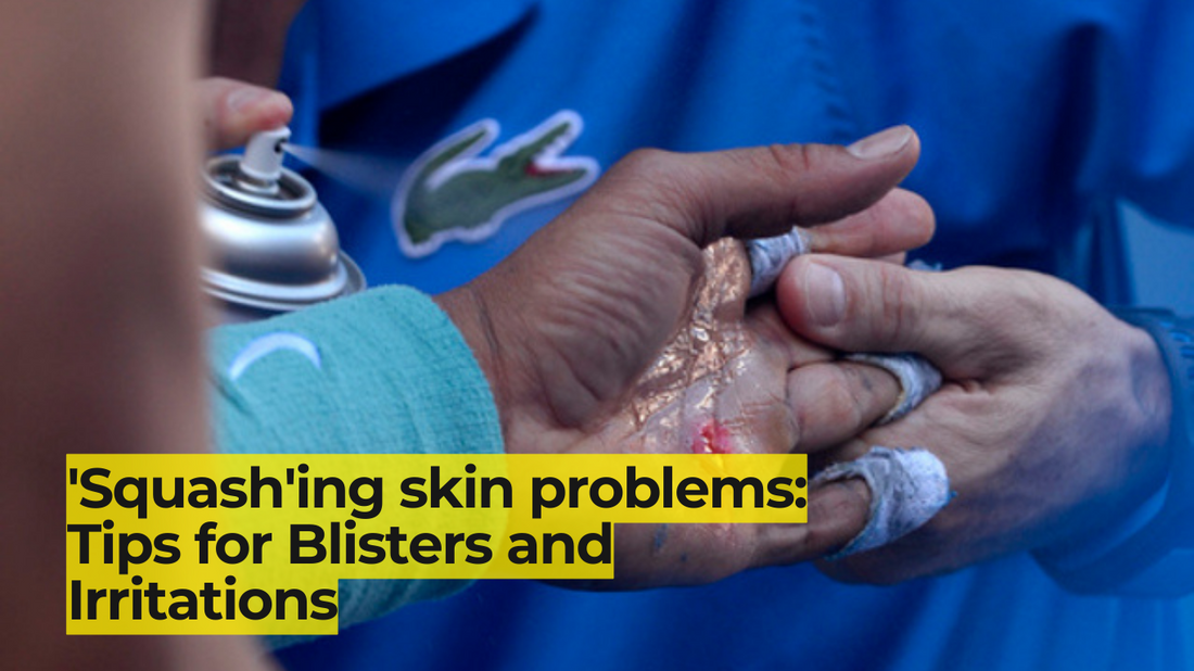 'Squash'ing skin problems: Tips for Blisters and Irritations