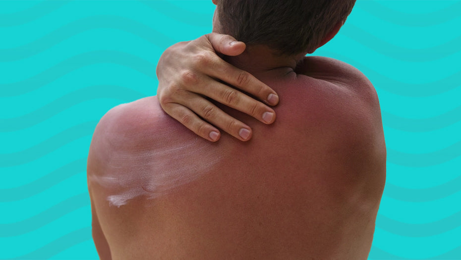 What to Apply on Skin Before Swimming to Prevent Itching